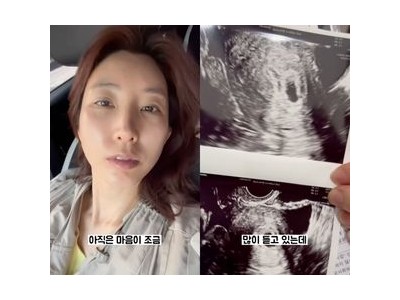 이특 누나 박인영 안타까운 소식 전해