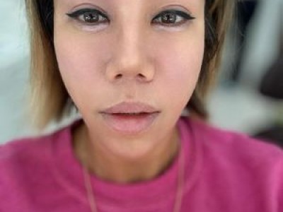 클론 강원래 아내 김송 병원 가야 한다는 말에 황당